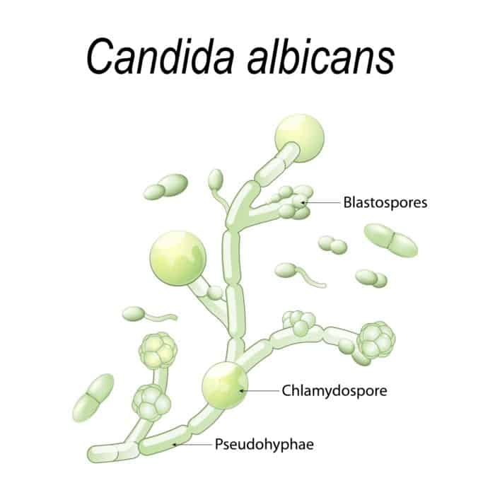 Candida Yeast OvergrowthCauses Symptoms And Solutions