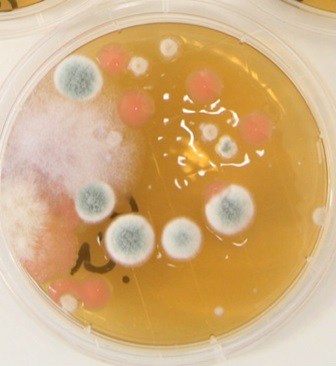 A petri dish showing four types of fungi suspected to have caused the man’s illness. (UHSM)