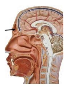 Mold in nose
